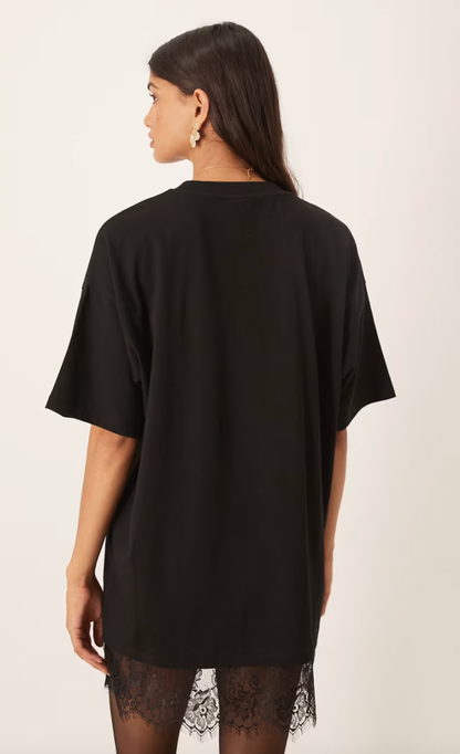 Aurrela | Oversized Mini Dress with Lace Hem Trim